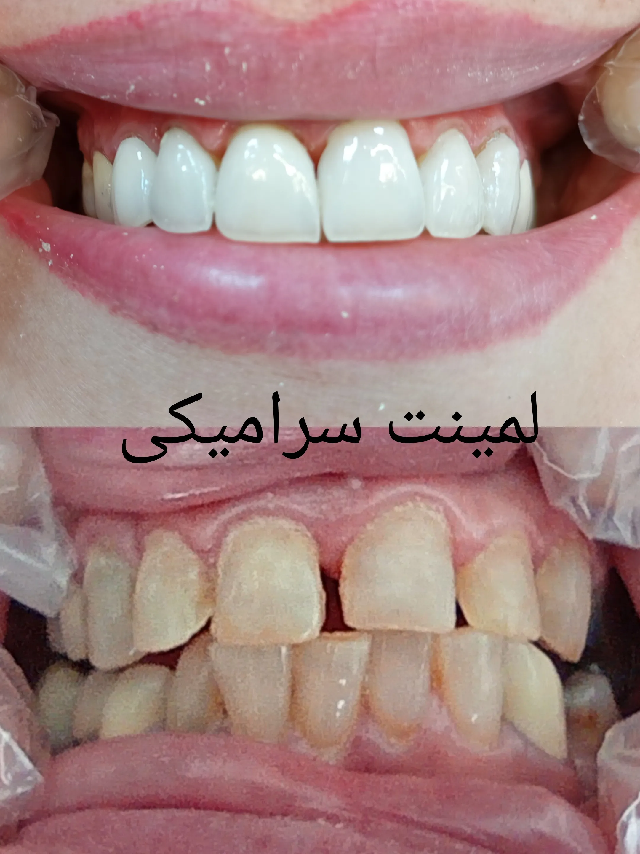 لمینیت دندانپزشکی دکتر مهدی اصلانی 