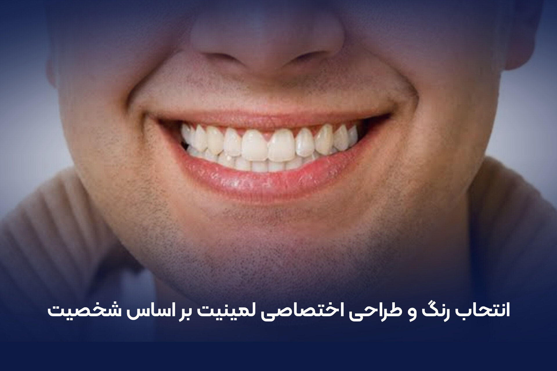 انتحاب رنگ و طراحی اختصاصی لمینیت بر اساس شخصیت