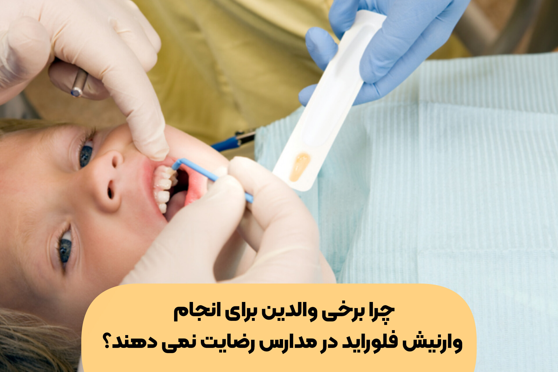 چرا برخی والدین برای انجام وارنیش فلوراید در مدارس رضایت نمی دهند؟