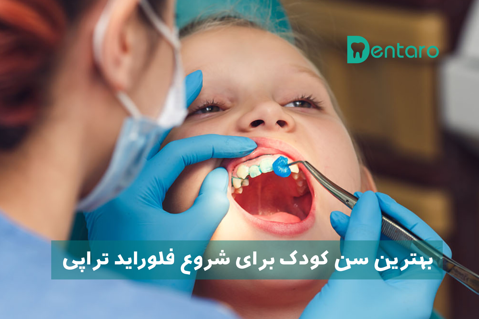 دنتارو بهترین سن کودک برای شروع فلوراید تراپی