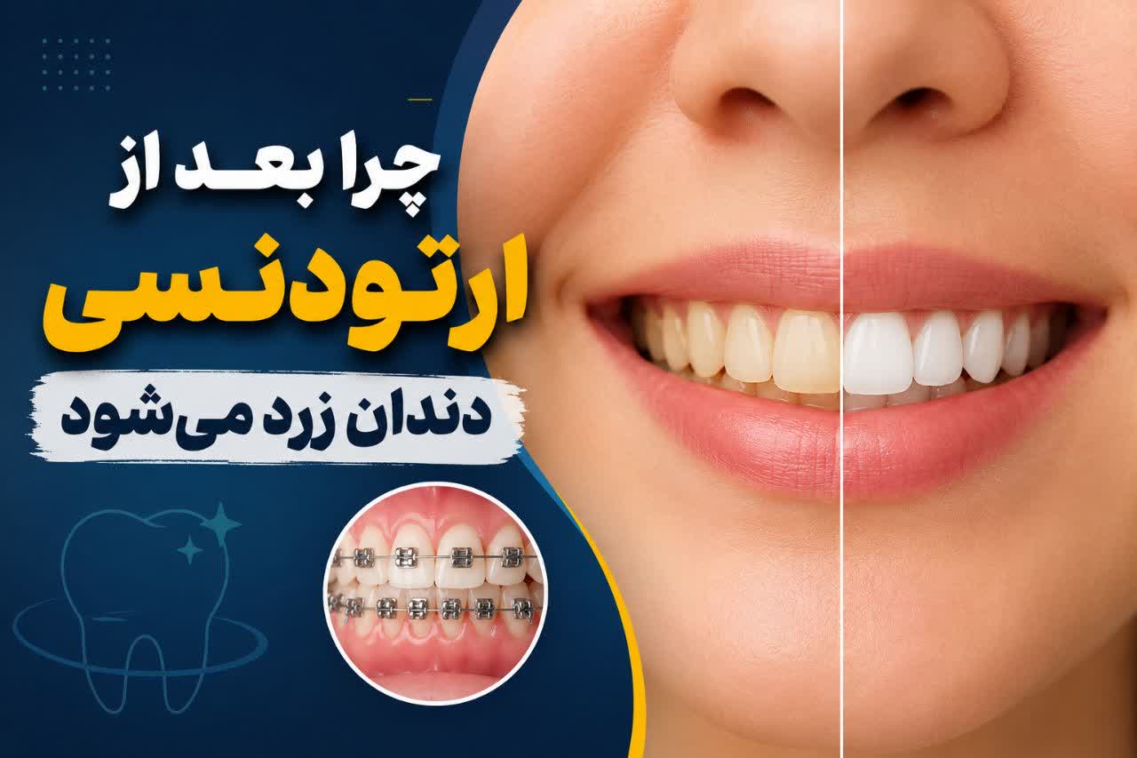 چرا بعد از ارتودنسی دندان زرد می‌شود