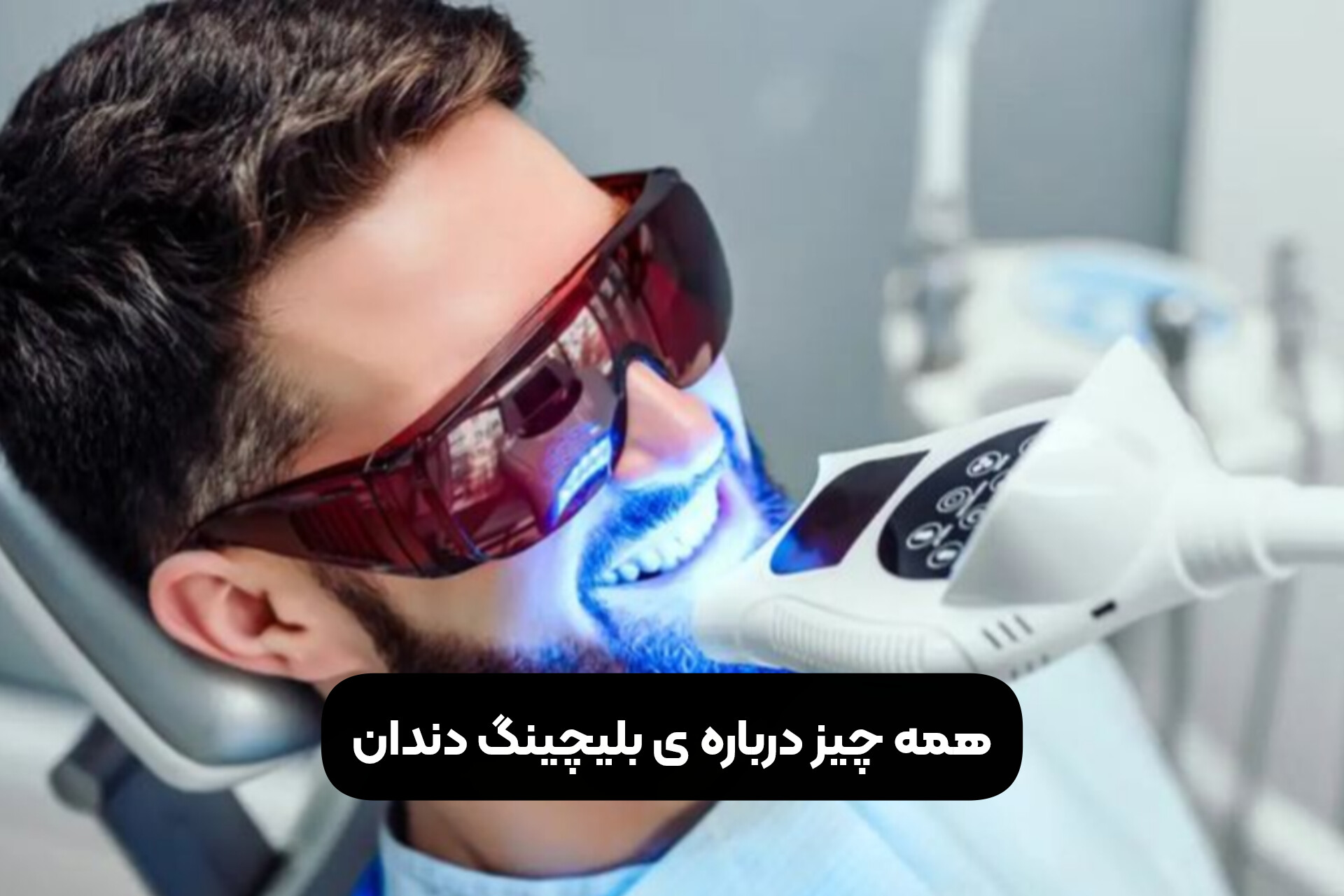 همه چیز درباره ی بلیچینگ دندان
