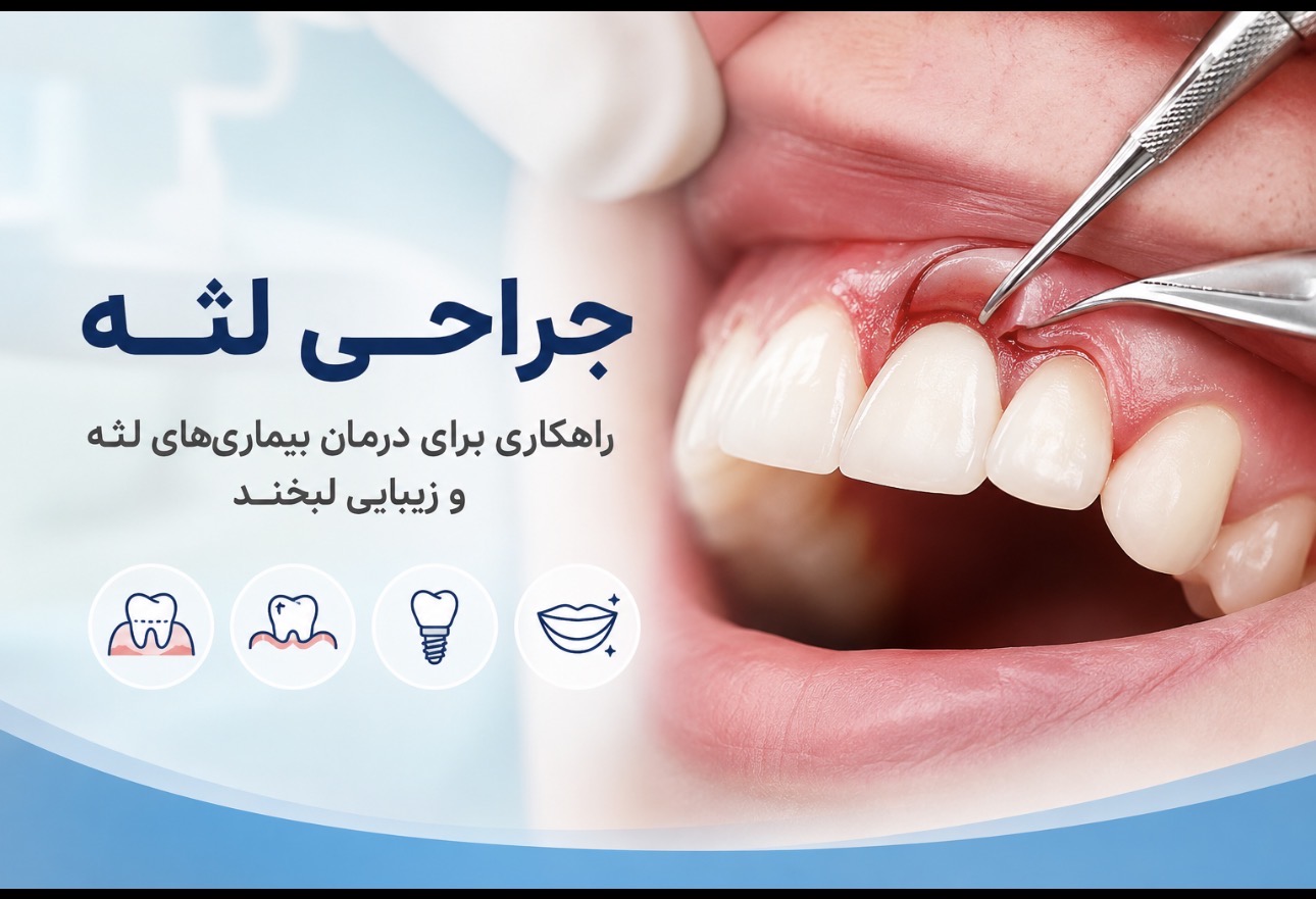 دنتارو همه چیز درباره جراحی لثه؛ از دلایل انجام تا مراقبت‌های  بعد درمان