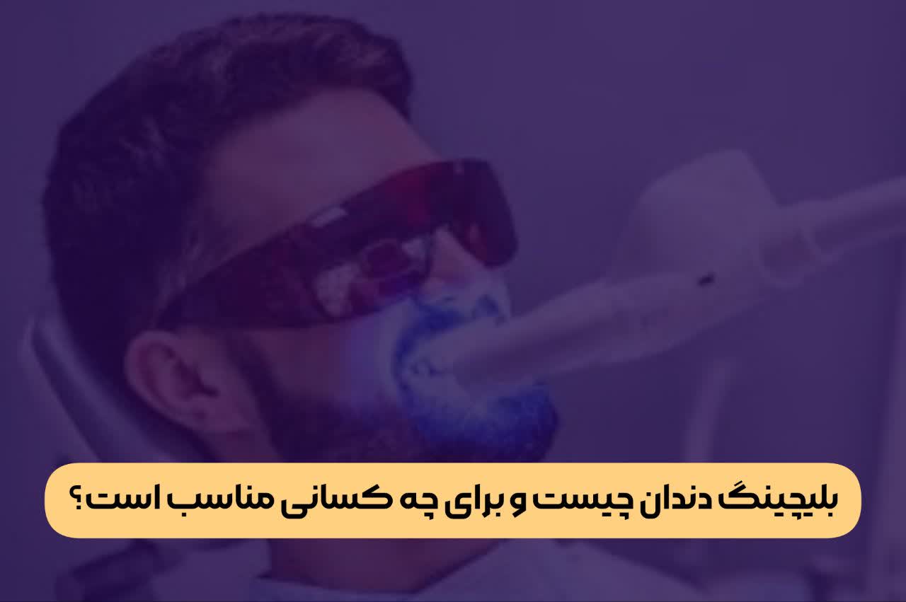 بلیچینگ دندان چیست و برای چه کسانی مناسب است ؟