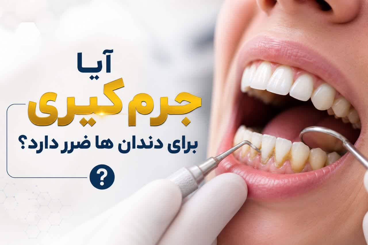 دنتارو آیا جرم گیری برای دندان ها ضرر دارد؟