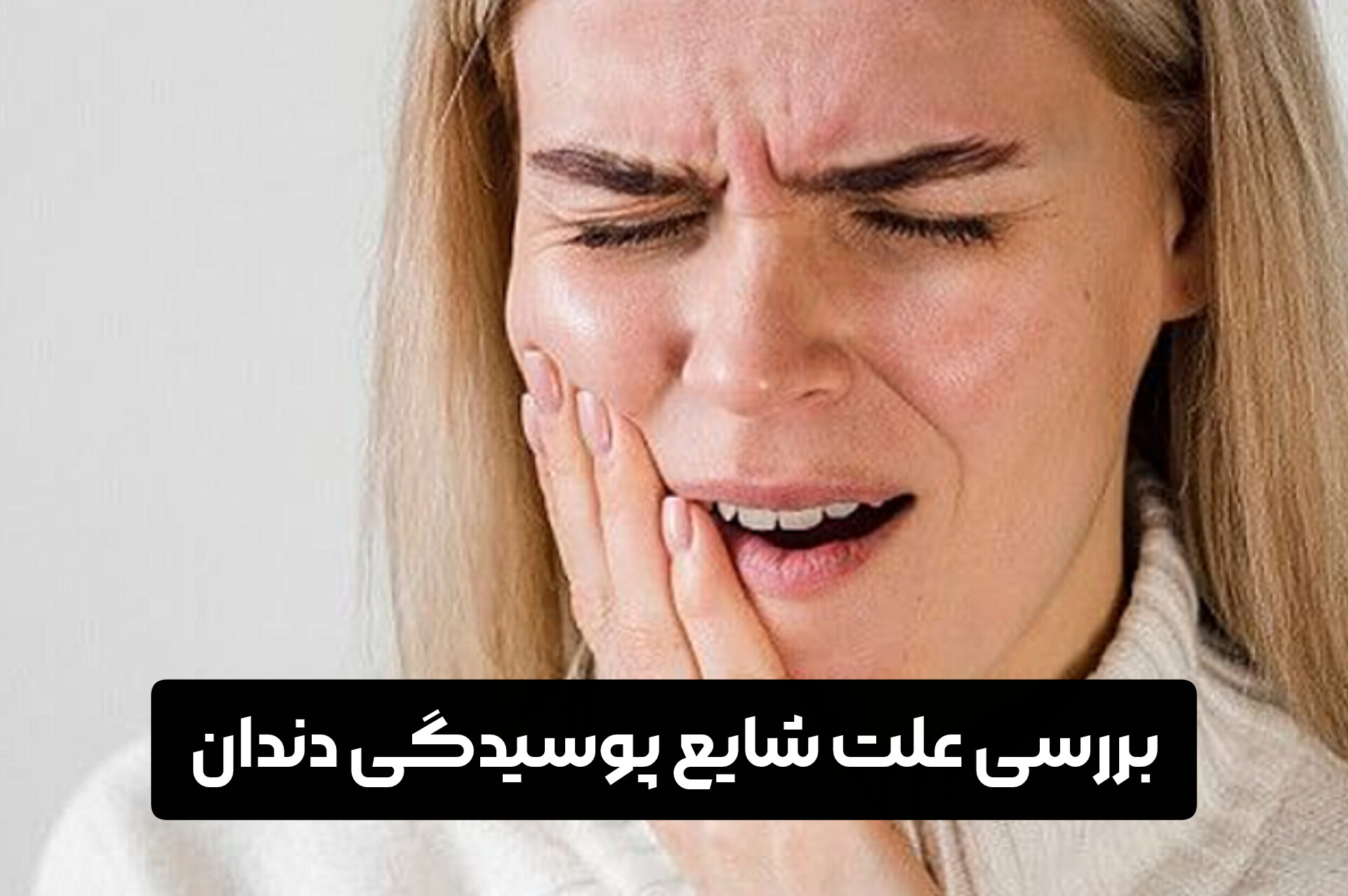 بررسی علت شایع پوسیدگی دندان