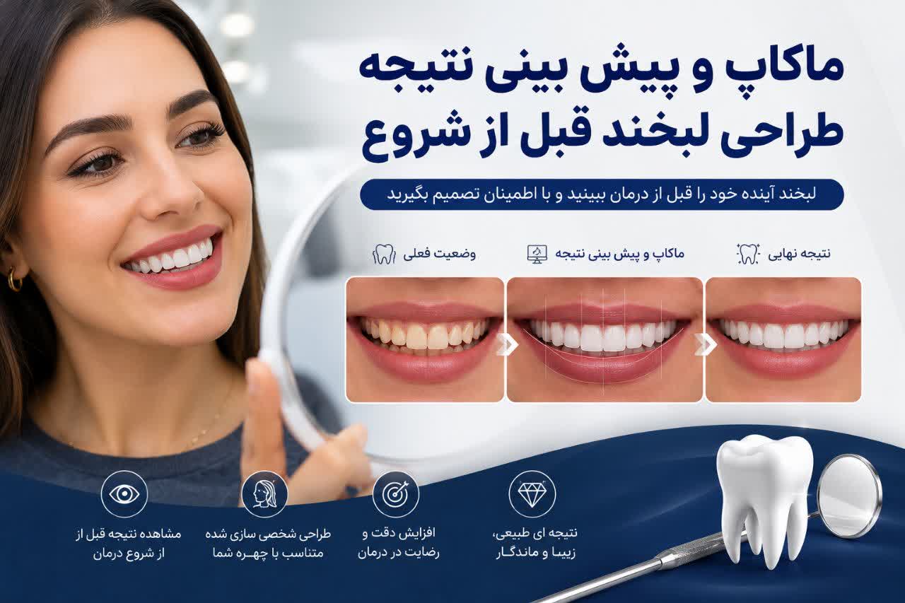 ماکاپ و پیش بینی نتیجه طراحی لبخند قبل از شروع