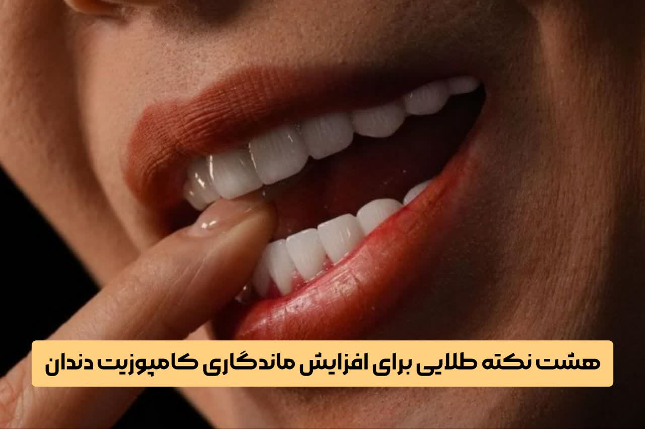هشت نکته طلایی برای افزایش ماندگاری کامپوزیت دندان
