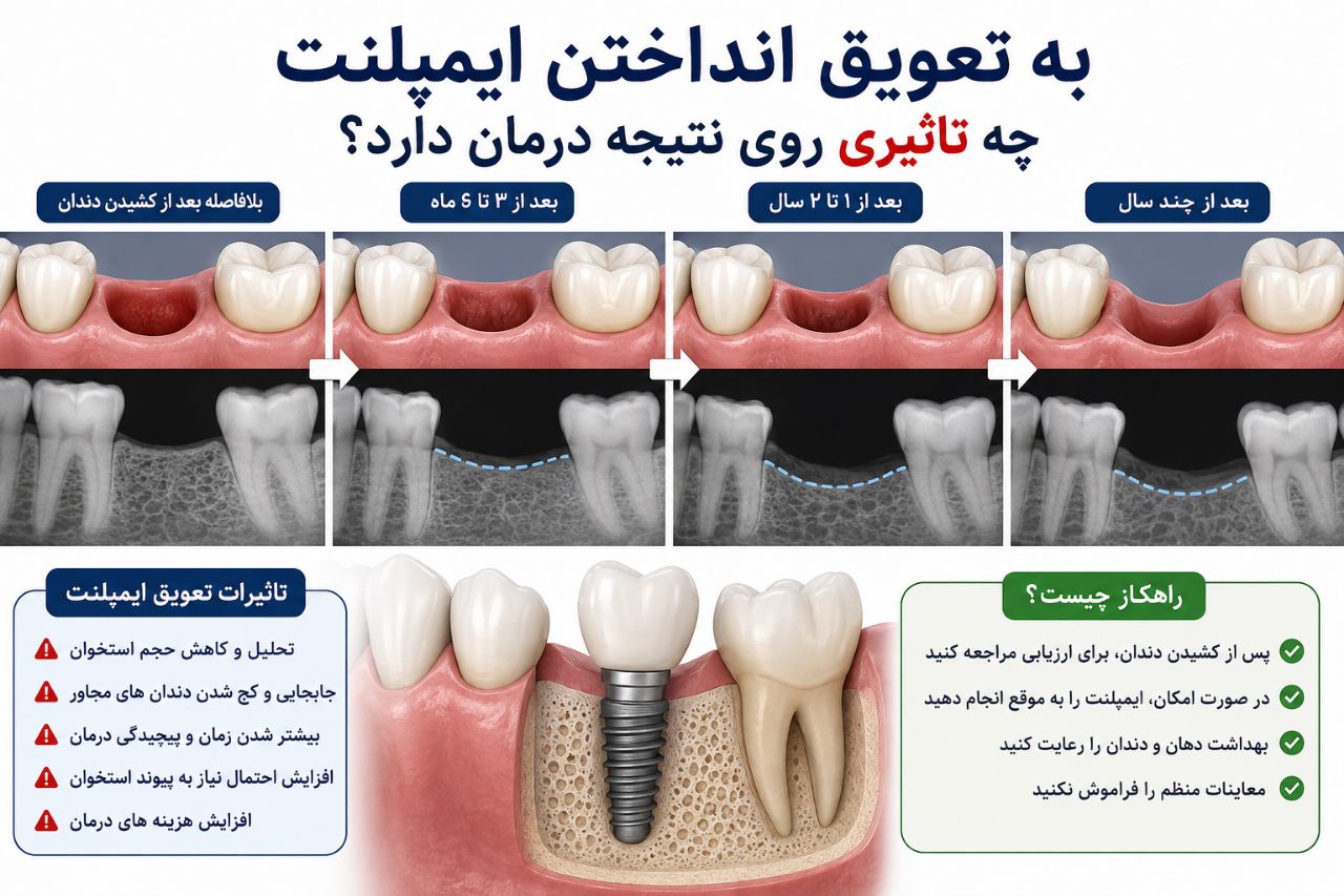 دنتارو به تعویق انداختن ایمپلنت چه تاثیری روی نتیجه درمان دارد؟