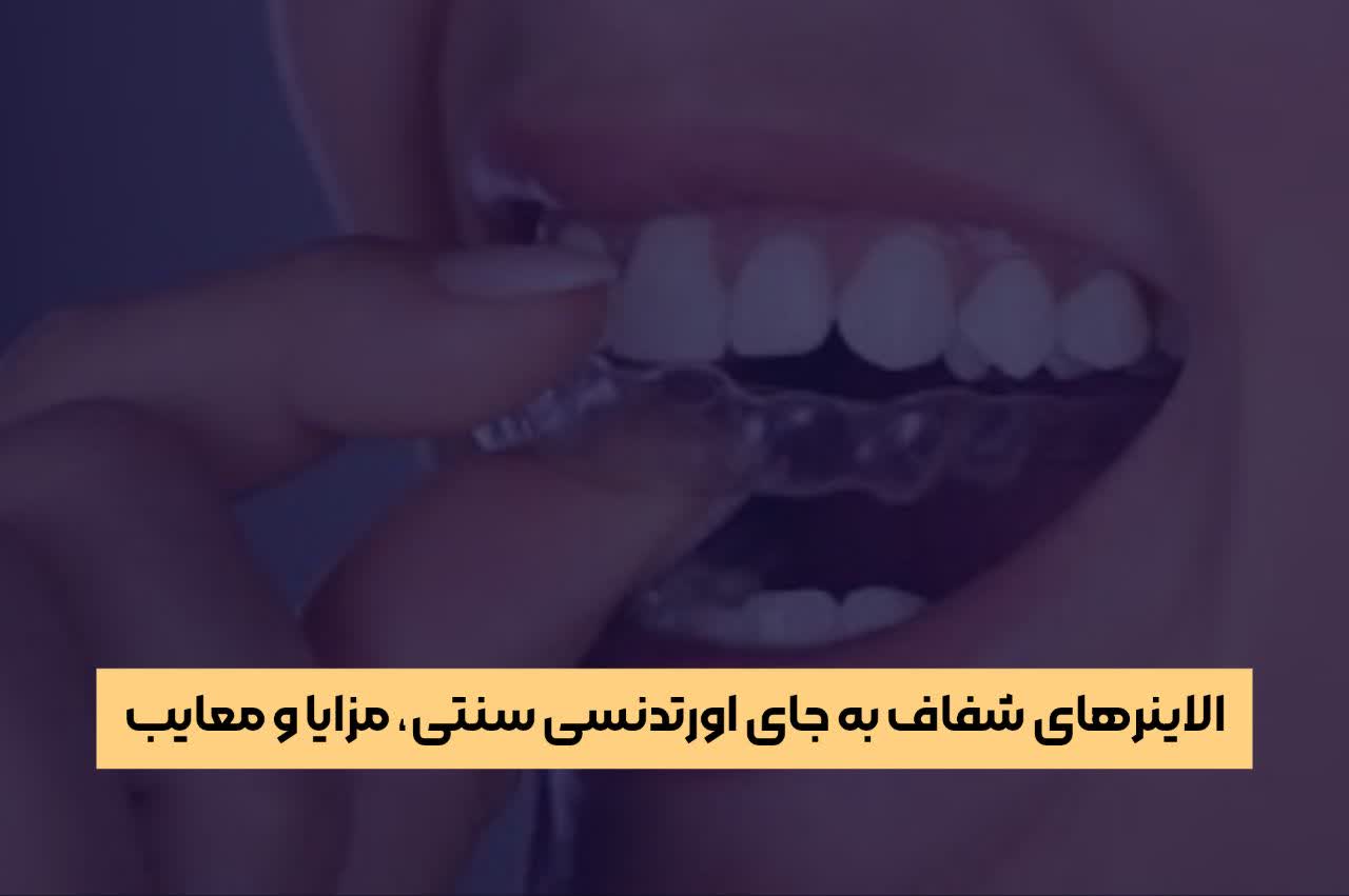الاینرهای شفاف به جای اورتدنسی سنتی، مزایا و معایب